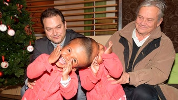 Twin girls conjoined at head successfully separated by doctors