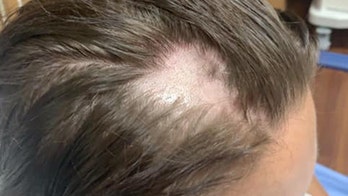 Woman claims Pantene conditioner, possibly contaminated with Nair, made her hair fall out