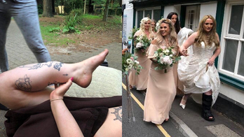 Bride nearly loses leg after freak bachelorette party accident: It 'just went snap'