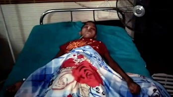 Teen has 3-pound hairball removed from stomach after complaining of pain, vomiting: report