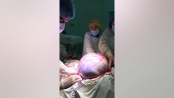 Surgeons remove 55-pound ovarian tumor from Russian patient, report says