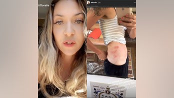 Influencer responds to critics who accused her of staging motorcycle accident photos for the 'Gram