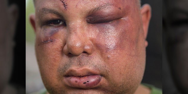 This 2018 photo shows beating victim Jorge Gomez. (Matthew Hinton/The Times-Picayune/The New Orleans Advocate via AP)