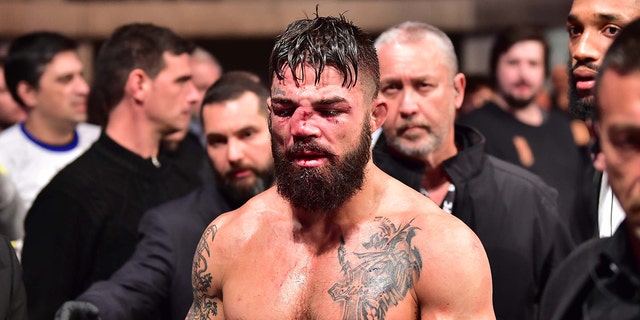 A look at Mike Perry's disfigured nose following his Aug. 10 UFC fight against Vicente Luque at Antel Arena in Uruguay. Jason Silva-USA TODAY Sports