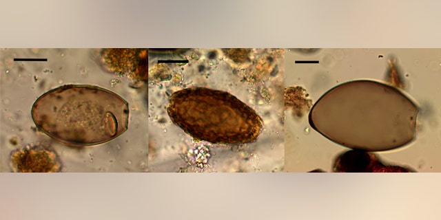 Microscopic eggs of fish tapeworm (left), giant kidney worm (center), and Echinostoma worm (right) from the Must Farm excavation. The black scale bar represents 20 micrometers. (Credit: M. Ledger, Department of Archaeology, Cambridge University)