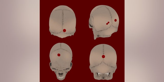 Holes had been made in the skulls, indicating that they may have been tied together with rope and put on display.