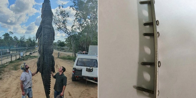 Lever had been told the surgical device was from a person's body and had been contacted by relatives of missing people anxious for clues.