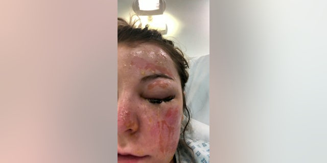 The UK woman claims she was hospitalized following the incident. (SWNS)