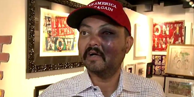 Jahangir Turan claims he was assualted Tuesday night for wearing a “Make American Great Again" hat that he had purchased earlier that day.