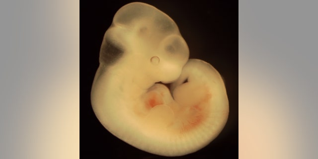 Researchers in Japan plan to transplant human cells into mouse and rat embryos. Above is a mouse embryo on Day 11 of development.