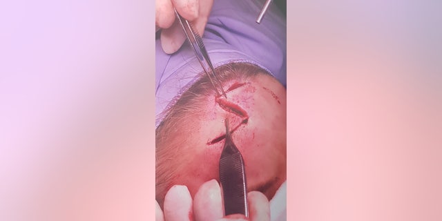 Brook required 20 stitches, she said. (SWNS)