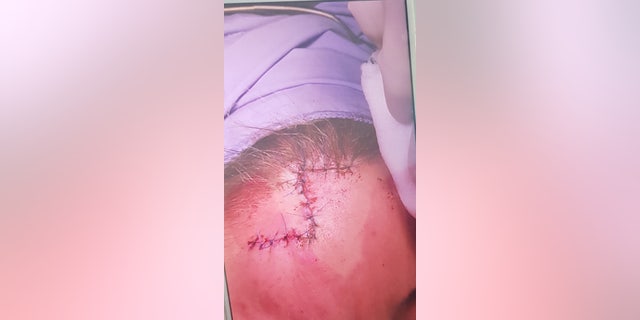 Erica Brook now hopes to raise awareness of the dangers of tanning beds. (SWNS)