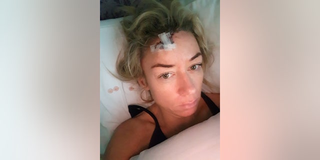 "What I am now left with is a permanent reminder of those sunbed visits and sun cream neglect," Brook said. (SWNS)