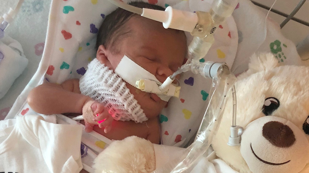 Her parents said she is expected to join her siblings at home in October, and that she is recovering well from surgery.