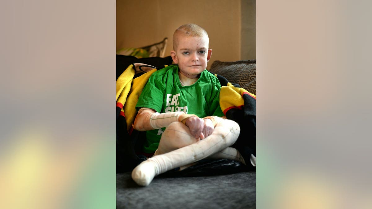 His mother said his life revolves around school, Xbox and sleep since he is unable to play outside with friends.