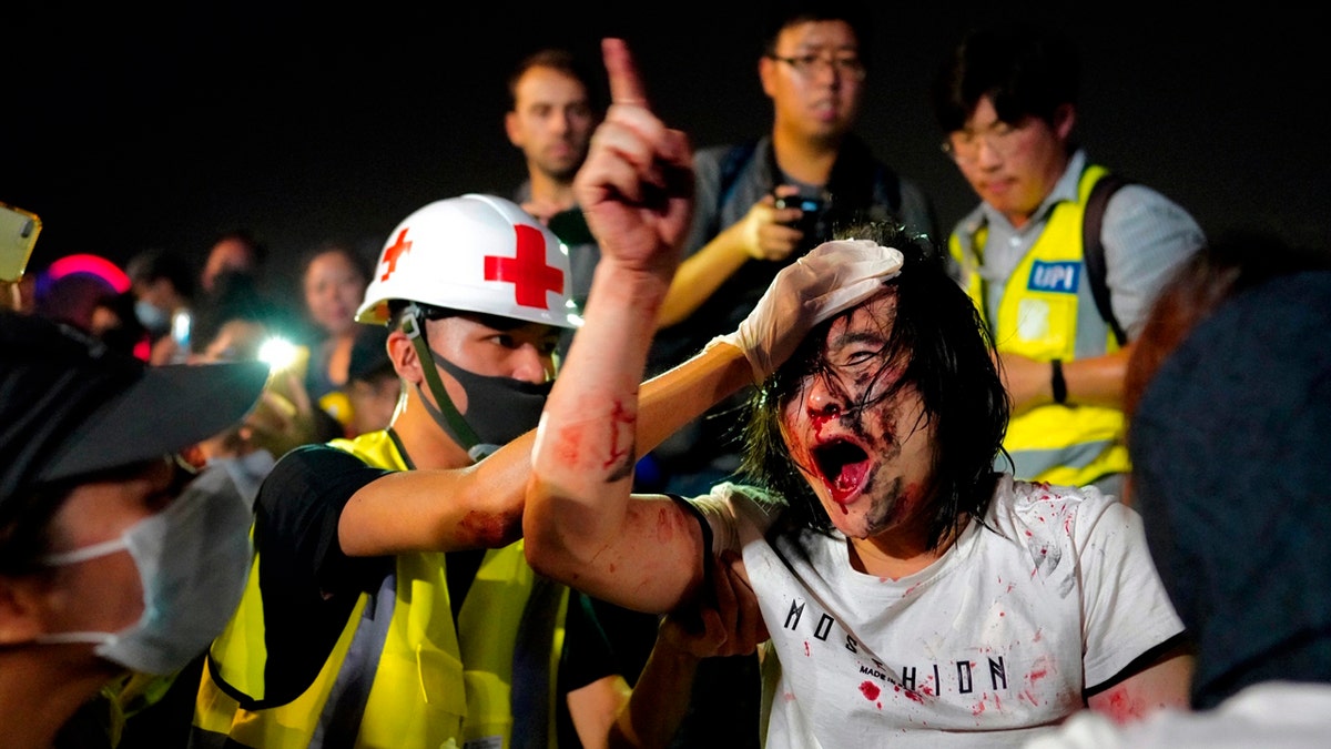 A medic treats a pro-Beijing man after he was hit by protesters for waving a Chinese national flag during a rally at Tamar park in Hong Kong, Saturday, Sept. 28, 2019. Thousands of people gathered Saturday for a rally in downtown Hong Kong, belting out songs, speeches and slogans to mark the fifth anniversary of the start of the 2014 Umbrella protest movement that called for democratic reforms in the semiautonomous Chinese territory. (AP Photo/Vincent Yu)