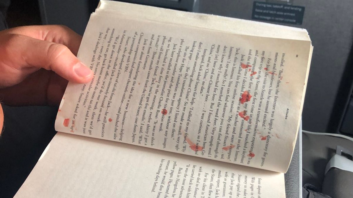 “Bloody mess on my flight to Miami. Woman in aisle seat has blister on her foot pop. Blood splatters across aisle, including on the two guys in front of me, one of their books, and the window,” passenger Andy Slater said of the scene.