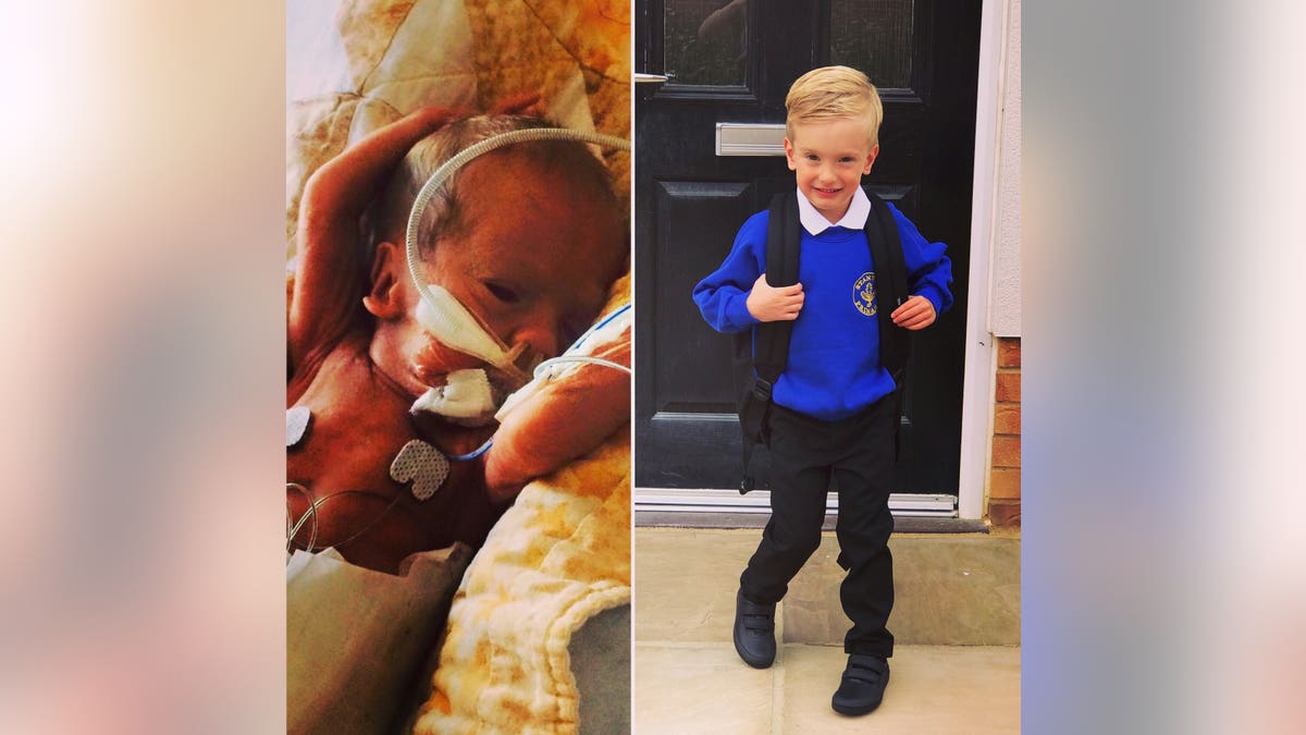 Roman Burns, who was born three months early, has started school.