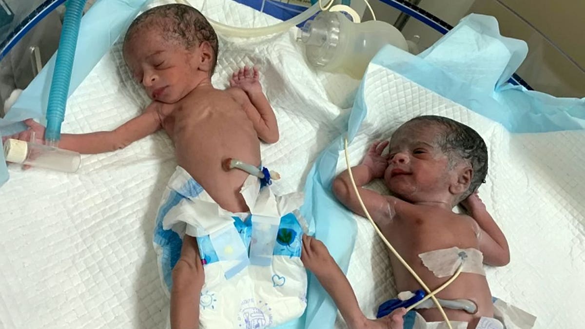 The girls were born healthy and each weighs around 4.4 pounds, hospital staff said.