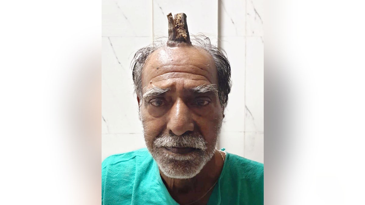 The man's barber had been shaving it down for him.