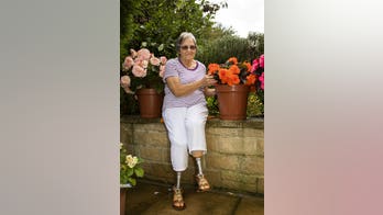 Grandma bitten by bug while gardening later loses legs, fingertips