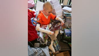 Thousands send cards to teen with rare skin disease after mom's plea goes viral