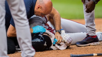 Atlanta Braves’ Culberson suffers facial fractures after taking pitch to face on bunt attempt, team says
