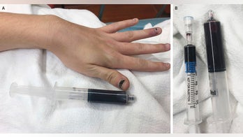 Rhode Island woman’s blood turns black after using over-the-counter medication for toothache