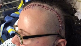 Woman's massive brain tumor discovered after she complained of 'phantom smells' like burnt toast