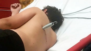 Boy, 12, survives 'freak' trampoline accident after metal spring shot into his  back 'like a bullet'