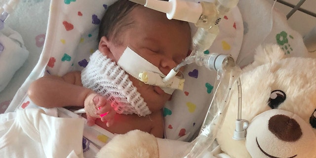 Her parents said she is expected to join her siblings at home in October, and that she is recovering well from surgery.