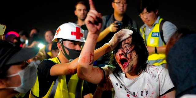 A medic treats a pro-Beijing demonstrator after he was hit by protesters Saturday. (AP Photo/Vincent Yu)