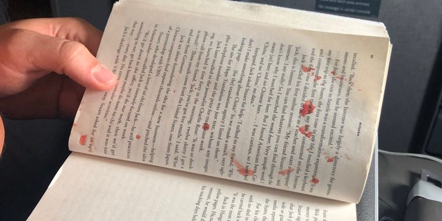 “Bloody mess on my flight to Miami. Woman in aisle seat has blister on her foot pop. Blood splatters across aisle, including on the two guys in front of me, one of their books, and the window,” passenger Andy Slater said of the scene.