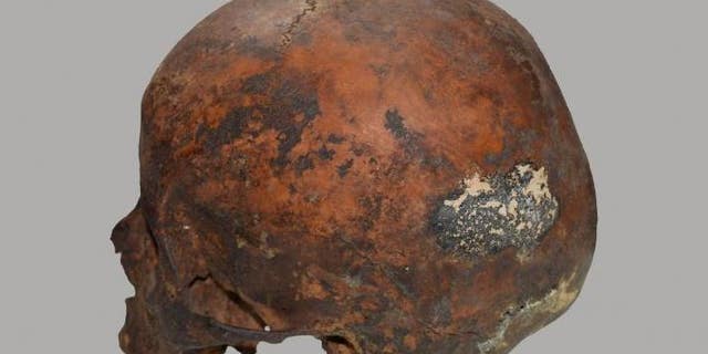 Skull of a boy from Ampato volcano, burned by lightning. Photo by D. Socha