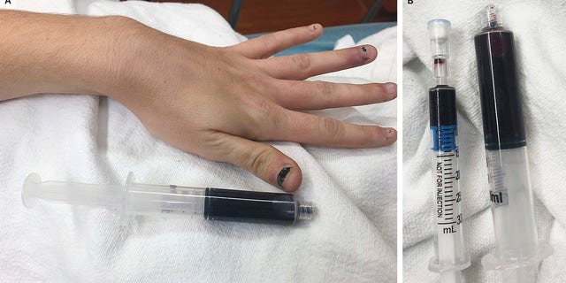 The woman's blood turned a black color after she used medication to treat a toothache.