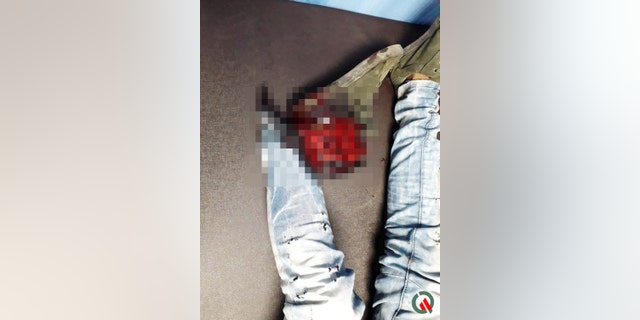 Sharma claims he was left on the side of the road — his severed foot still in his shoe, lying next to him on the ground — for nearly an hour before a stranger took him to the hospital,