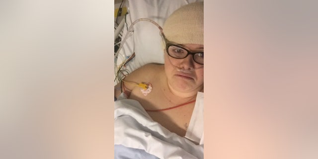 Yasmin Clapp after her operation. (SWNS)