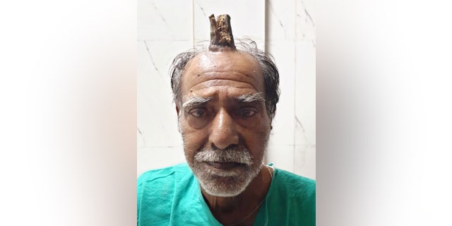 The man's barber had been shaving it down for him.