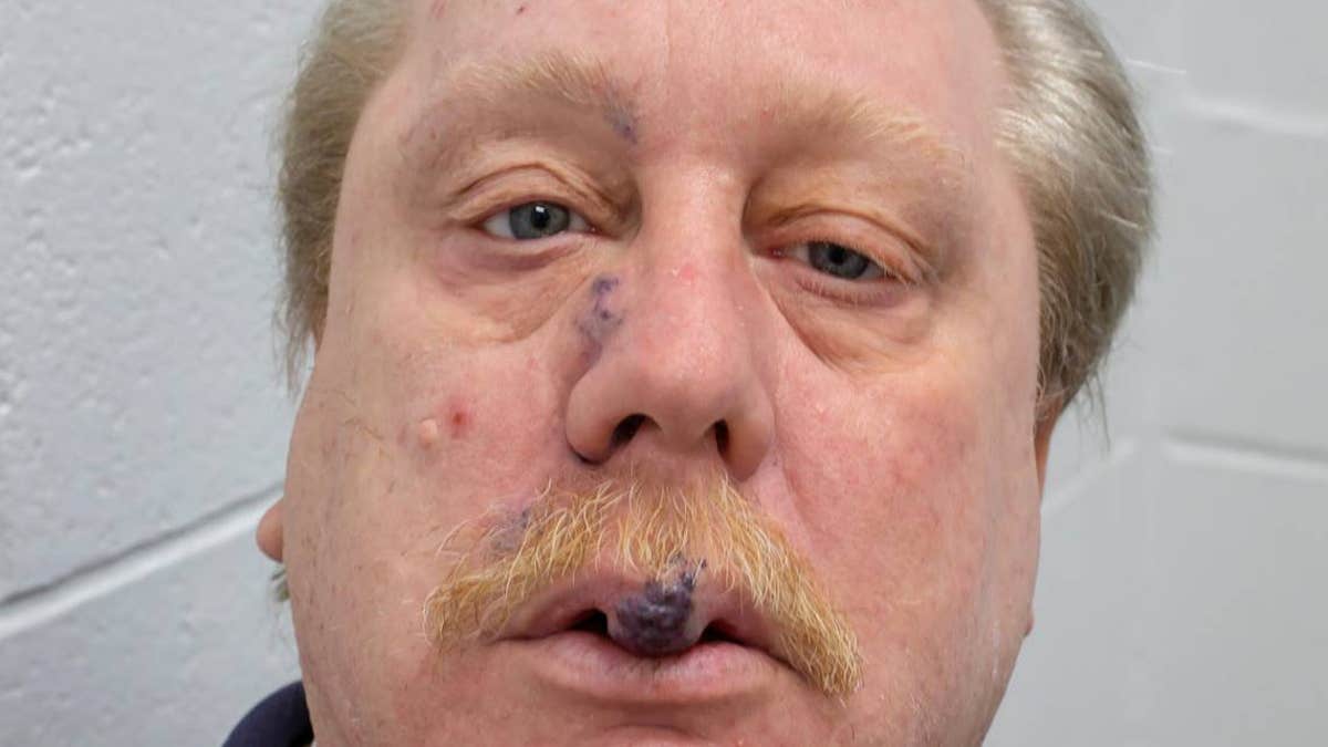 Russell Bucklew's unusual medical condition is grave enough to halt his execution, his lawyers say.