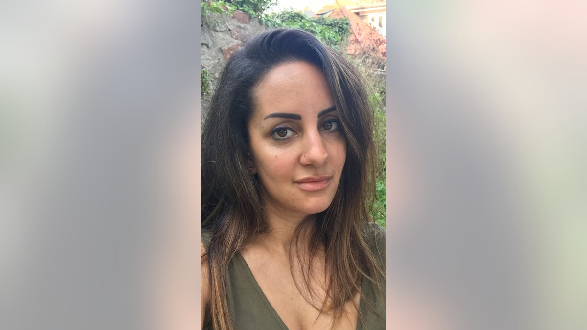 Najjar, pictured after her lips had healed, said she was feeling self-conscious about her lips ahead of her 30th birthday, and decided to get fillers.