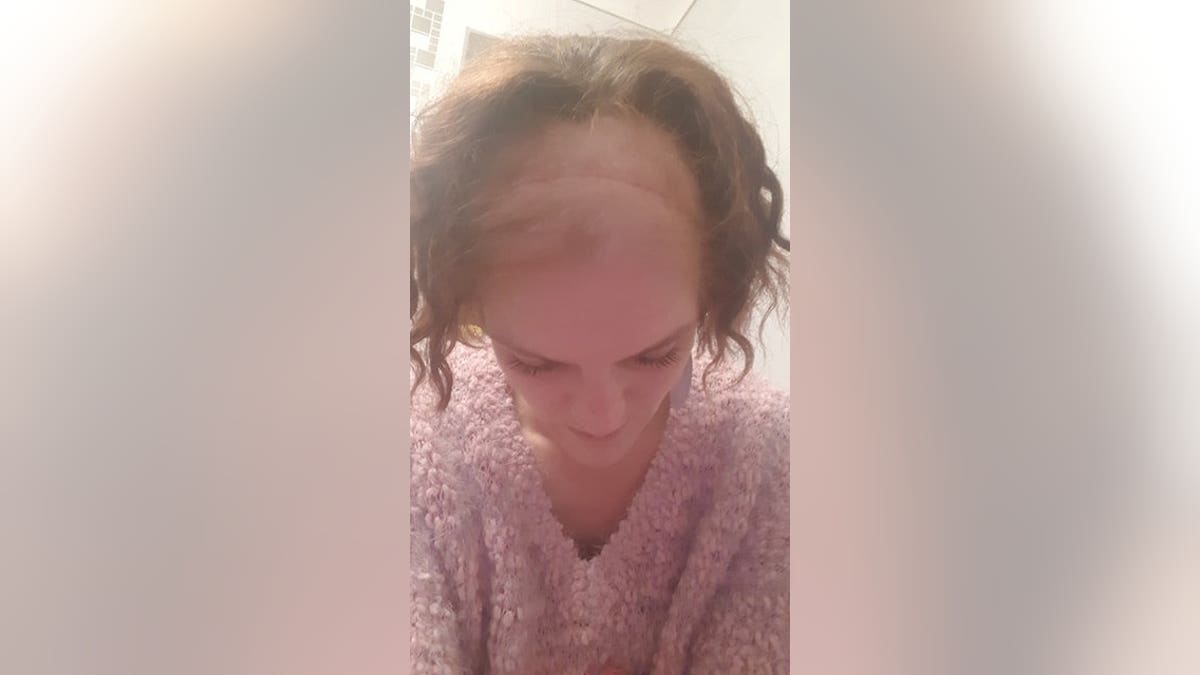 Cliare Curtis shows the scar caused by her brain surgery and her thinning hair due to chemotherapy treatments.