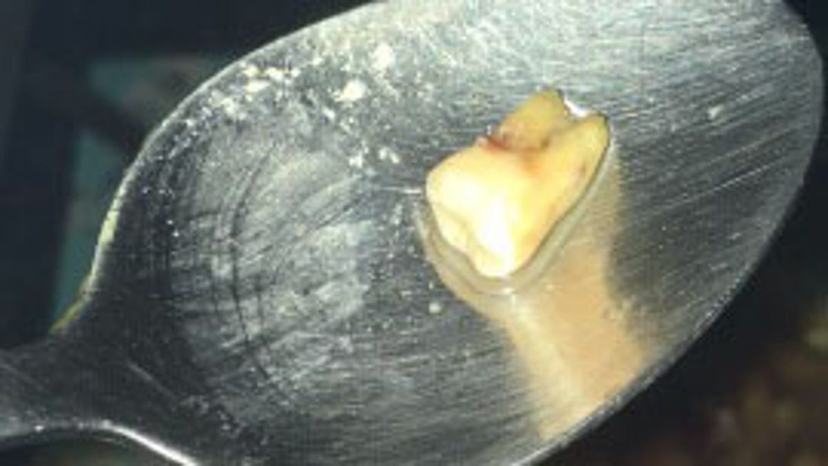 tooth found in chinese food