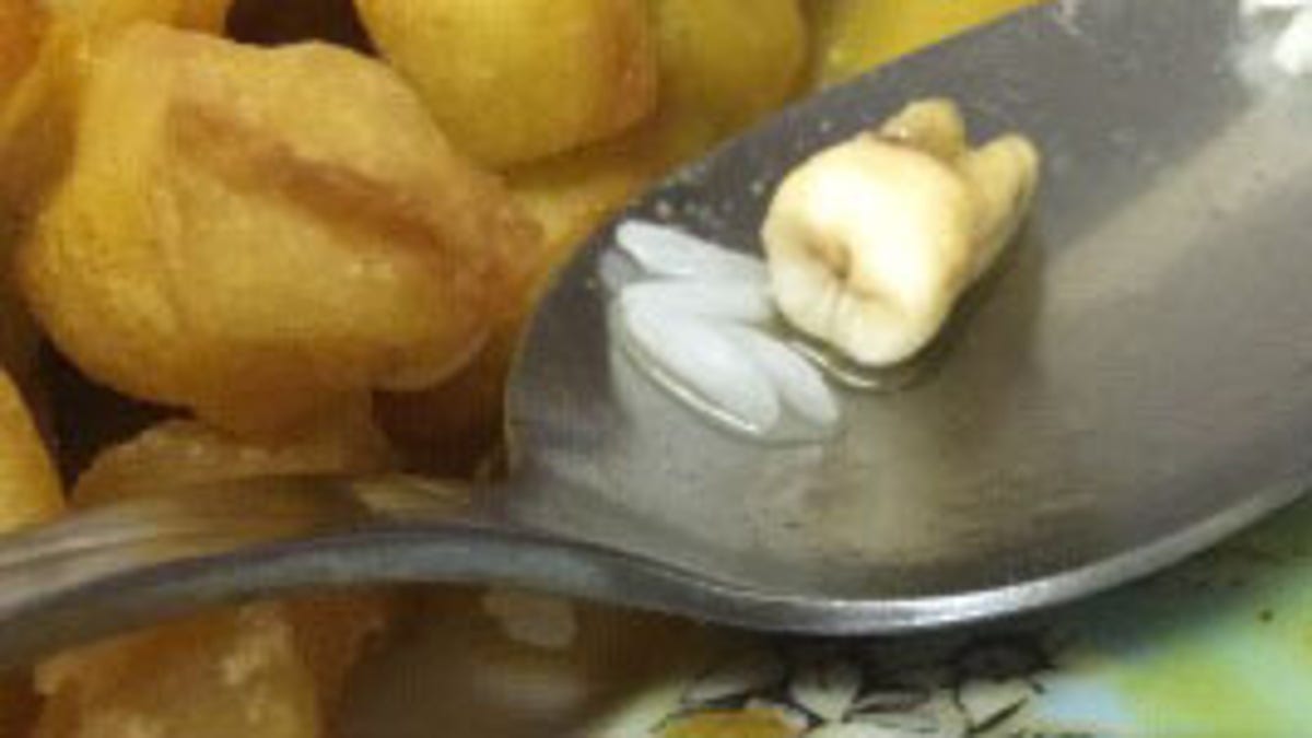 tooth in chinese food