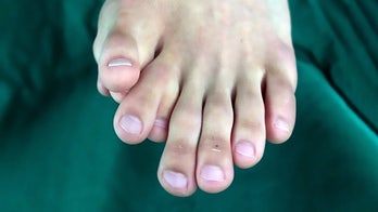 Man says being born with 9 toes was not 'lucky' sign like his parents claimed