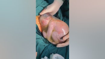 Baby born with amniotic sac intact, photos show
