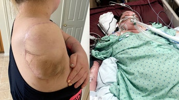 Mom loses arm to flesh-eating bacteria, felt 'helpless' after waking from coma