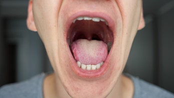 Why did this man's taste buds disappear?