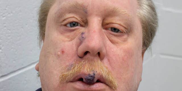 Russell Bucklew's unusual medical condition is grave enough to halt his execution, his lawyers say.