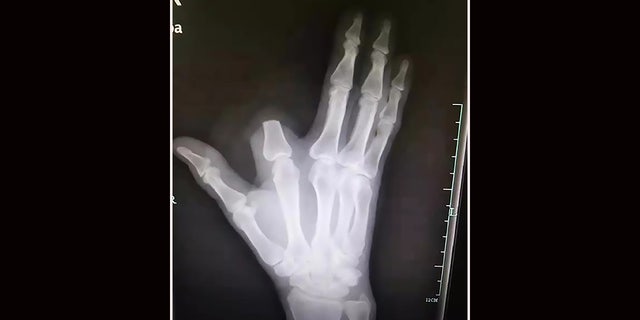 The man reportedly believed he was saving his own life, but his doctor blasted the move as