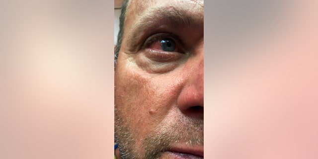 Alexander Swanson says in a lawsuit that he suffered an eye injury after being hit by a T-shirt fired from a T-shirt cannon.